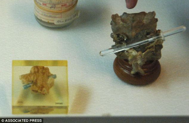 Booth vertebrae spine AP