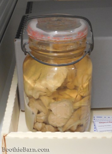 Charles Guiteau's brain NMHM