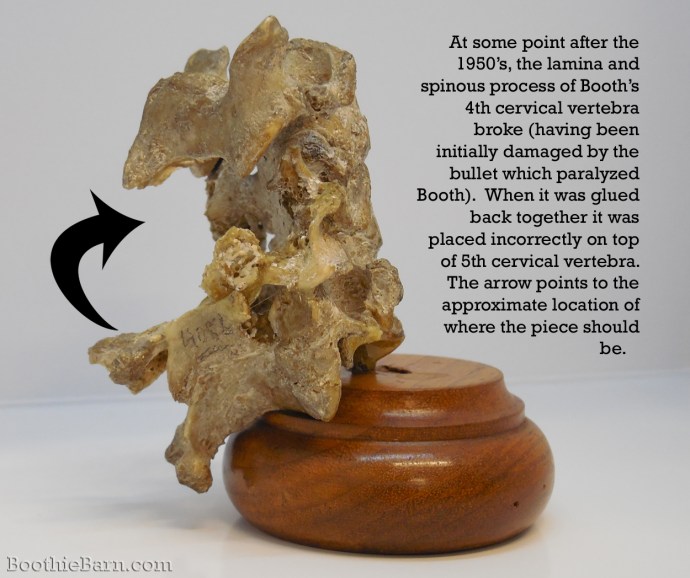 John Wilkes Booth's broken vetebrae