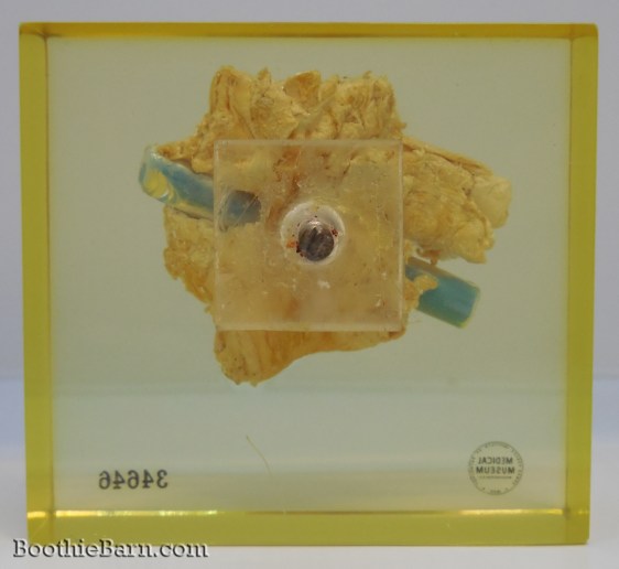 John Wilkes Booth's Spinal Cord 2