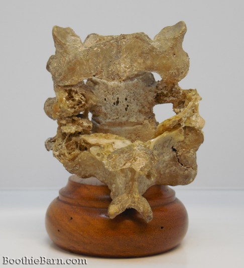 John Wilkes Booth's vertebrae 1
